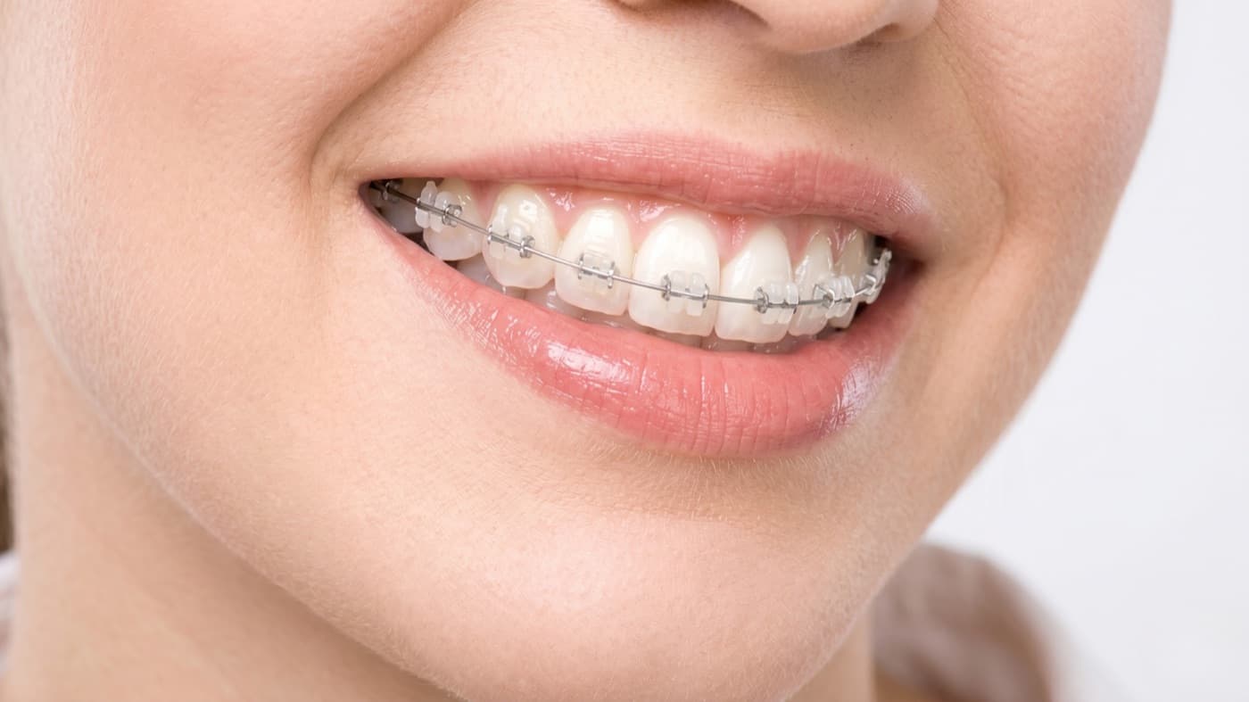 Diş Tedavisine Başlamadan Önce Sorulabilecek Temel Sorular