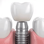 Periodontoloji